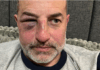 Comerciante de Brinkmann fue agredido tras intervenir en una gresca frente a su comercio