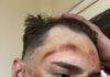 Brutal agresión a un jugador de Sportivo Pozo del Molle