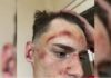Suspensión de Lautaro Gonzalez, el jugador que golpeó a Agustín Mudryk, y citación del tribunal de disciplina